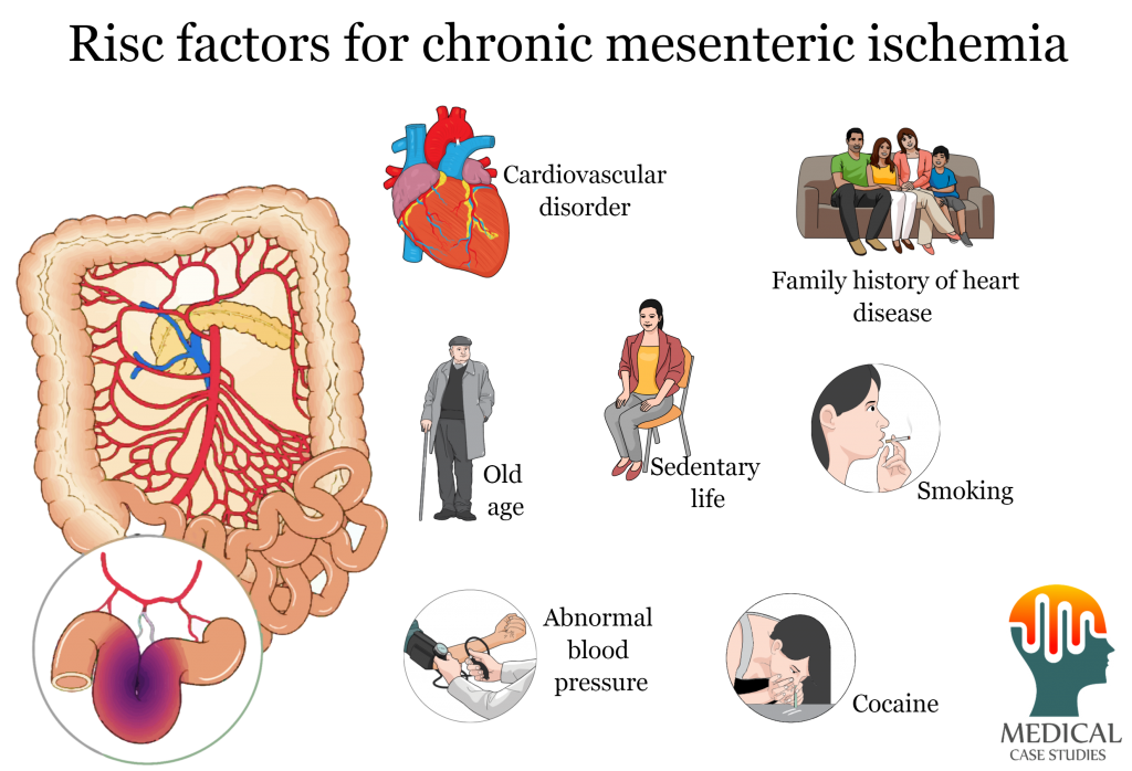 Predisposing factors for chronic mesenteric ischemia