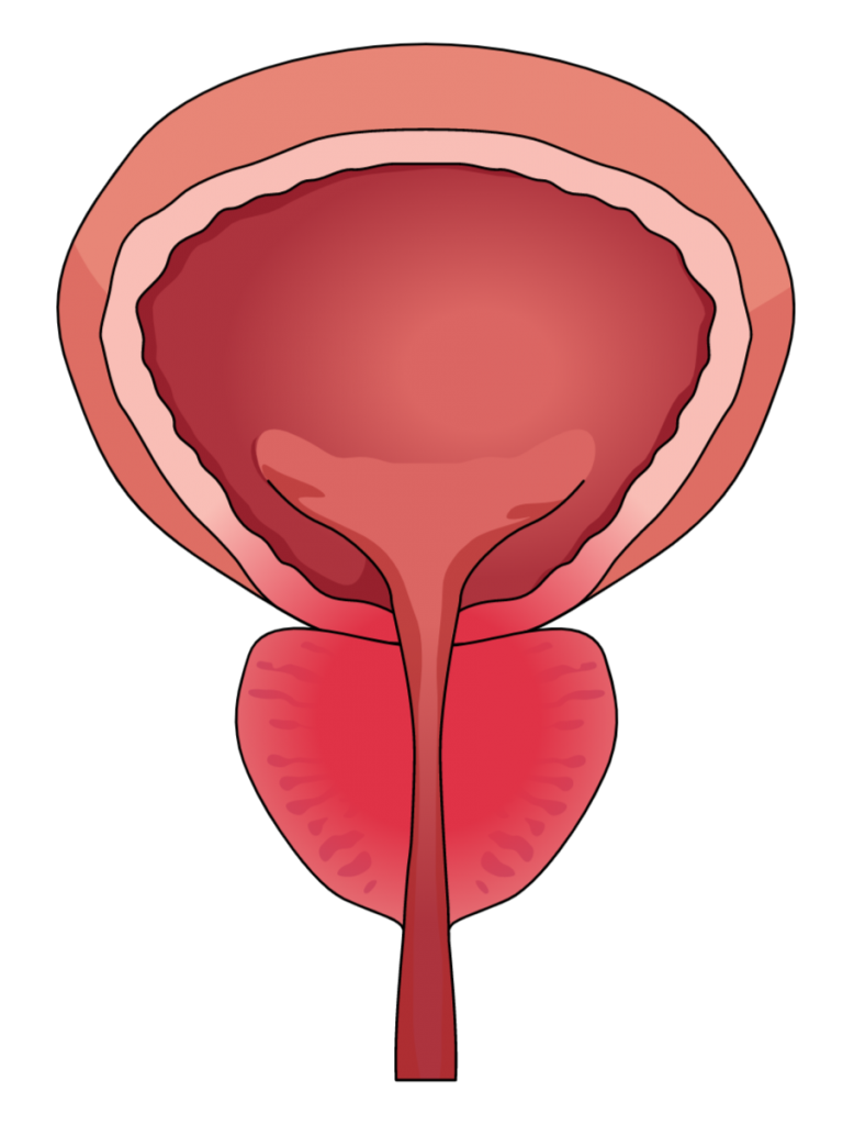 Prostate gland and IBS