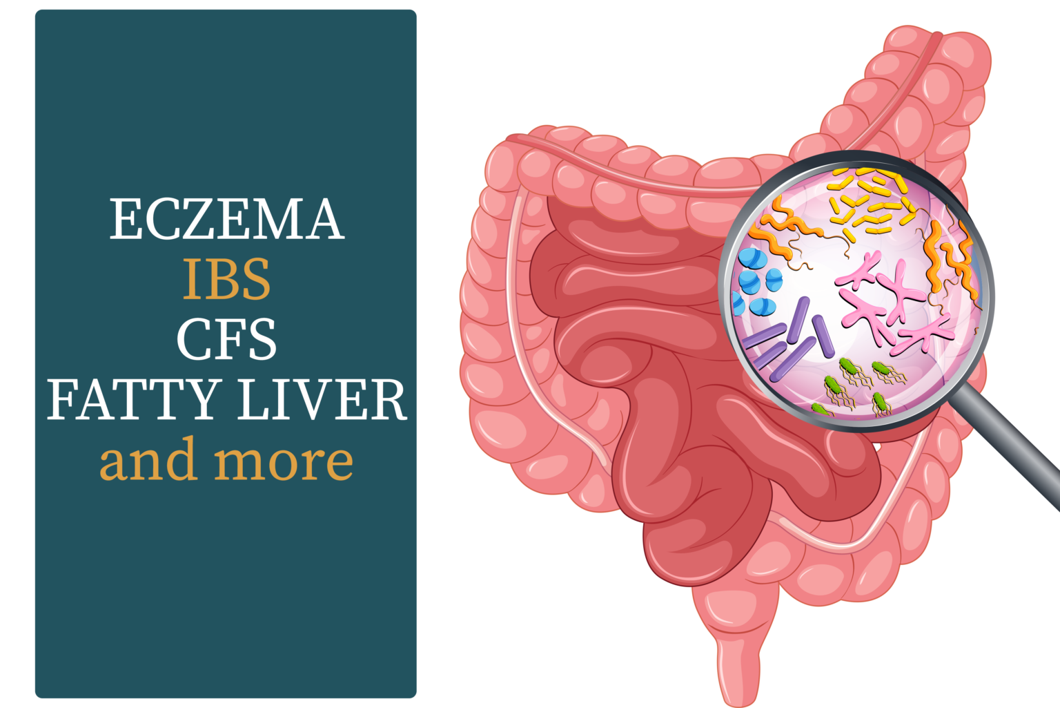 Why diagnosing the specific bacteria causing SIBO is so important ...