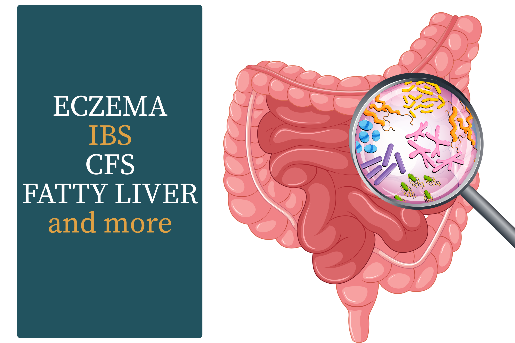 Why Diagnosing The Specific Bacteria Causing SIBO Is So Important ...