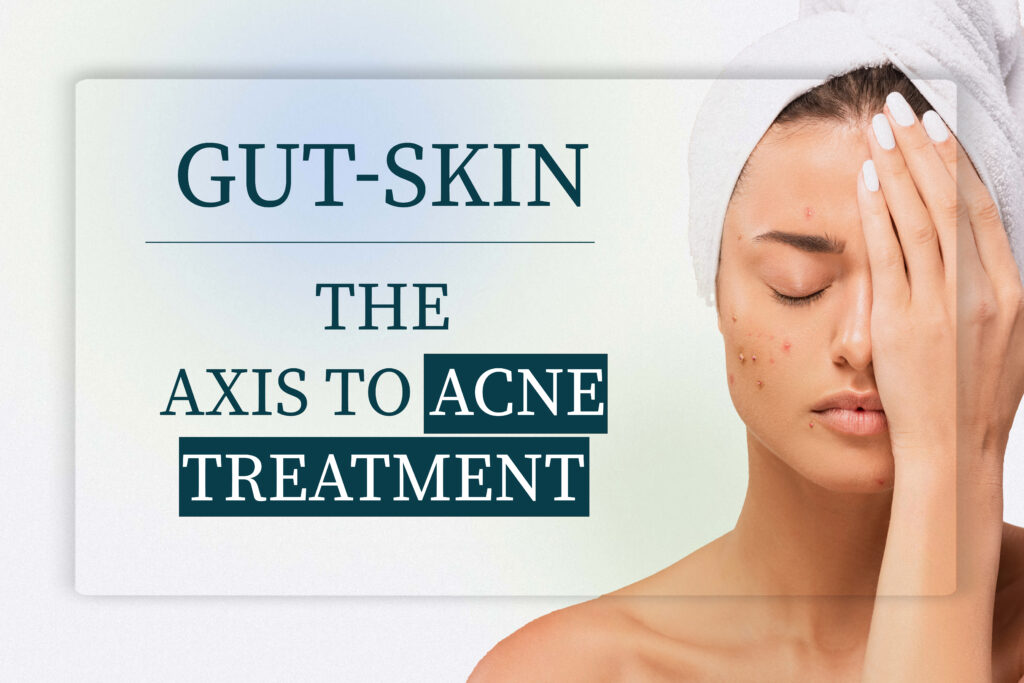 Improve gut health for acne. Gut-skin axis. Acne and gut microbiome