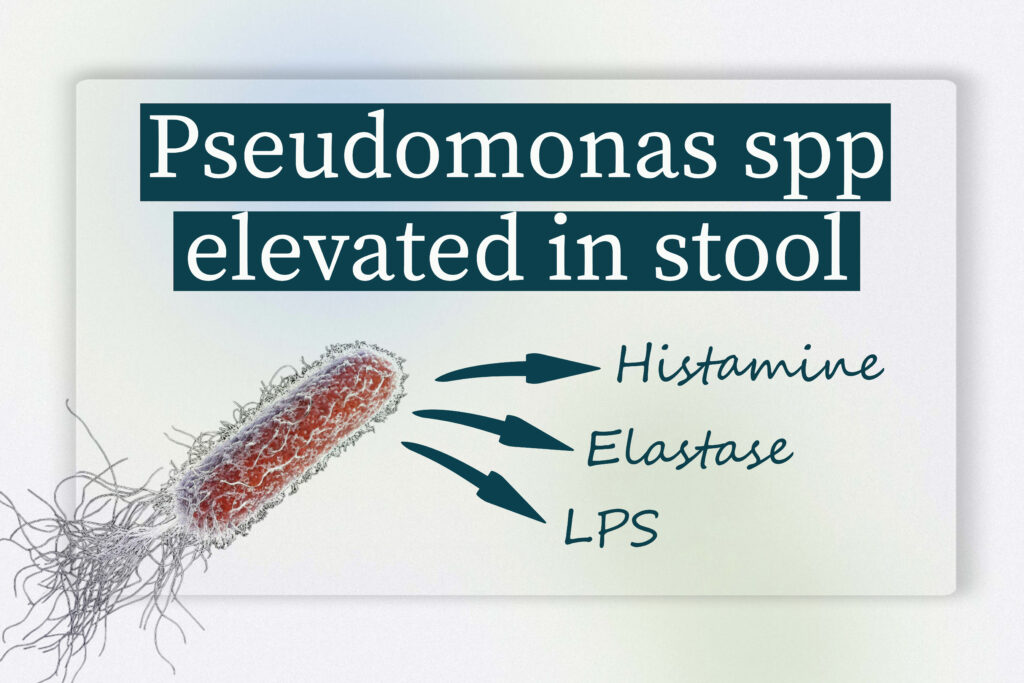 pseudomonas-spp-high-in-stool