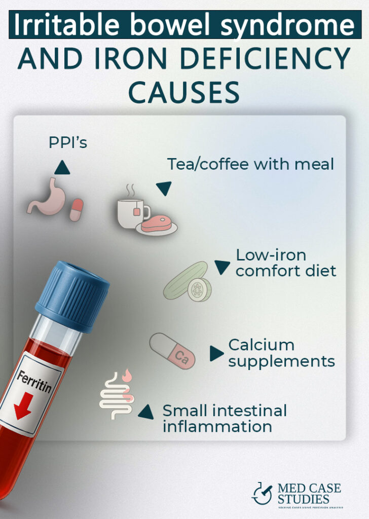 Irritable bowel syndrome and anemia — iron-deficiency causes shown: low ferritin vial, PPI use, tea/coffee with meals, low-iron diet, calcium supplements, small-intestinal inflammation.