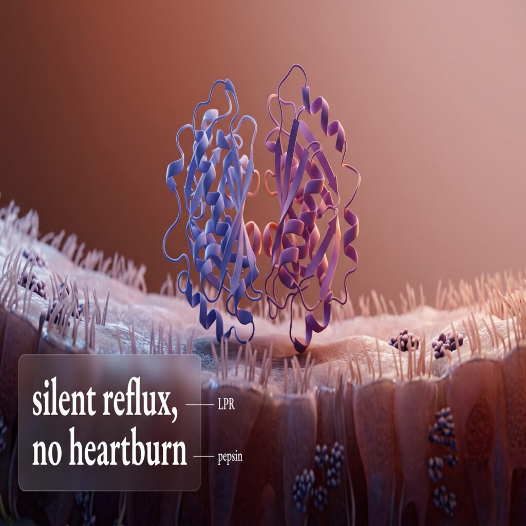 Acid reflux without heartburn shown as pepsin reactivating on the laryngeal mucosa