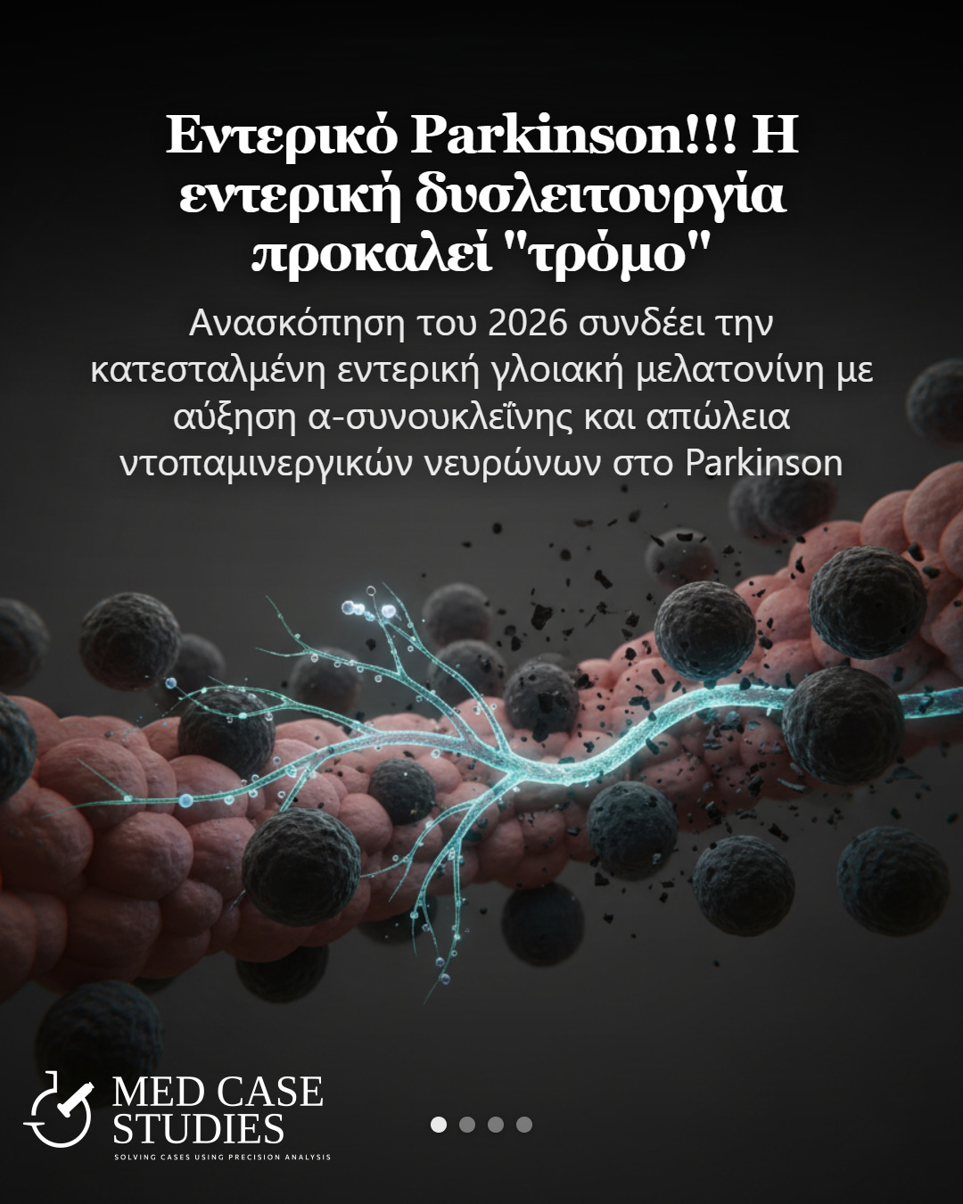 Καλλιτεχνική απεικόνιση εντερικού ιστού με φωτεινό νευρωνικό δίκτυο και σκοτεινά σφαιρικά σωματίδια.