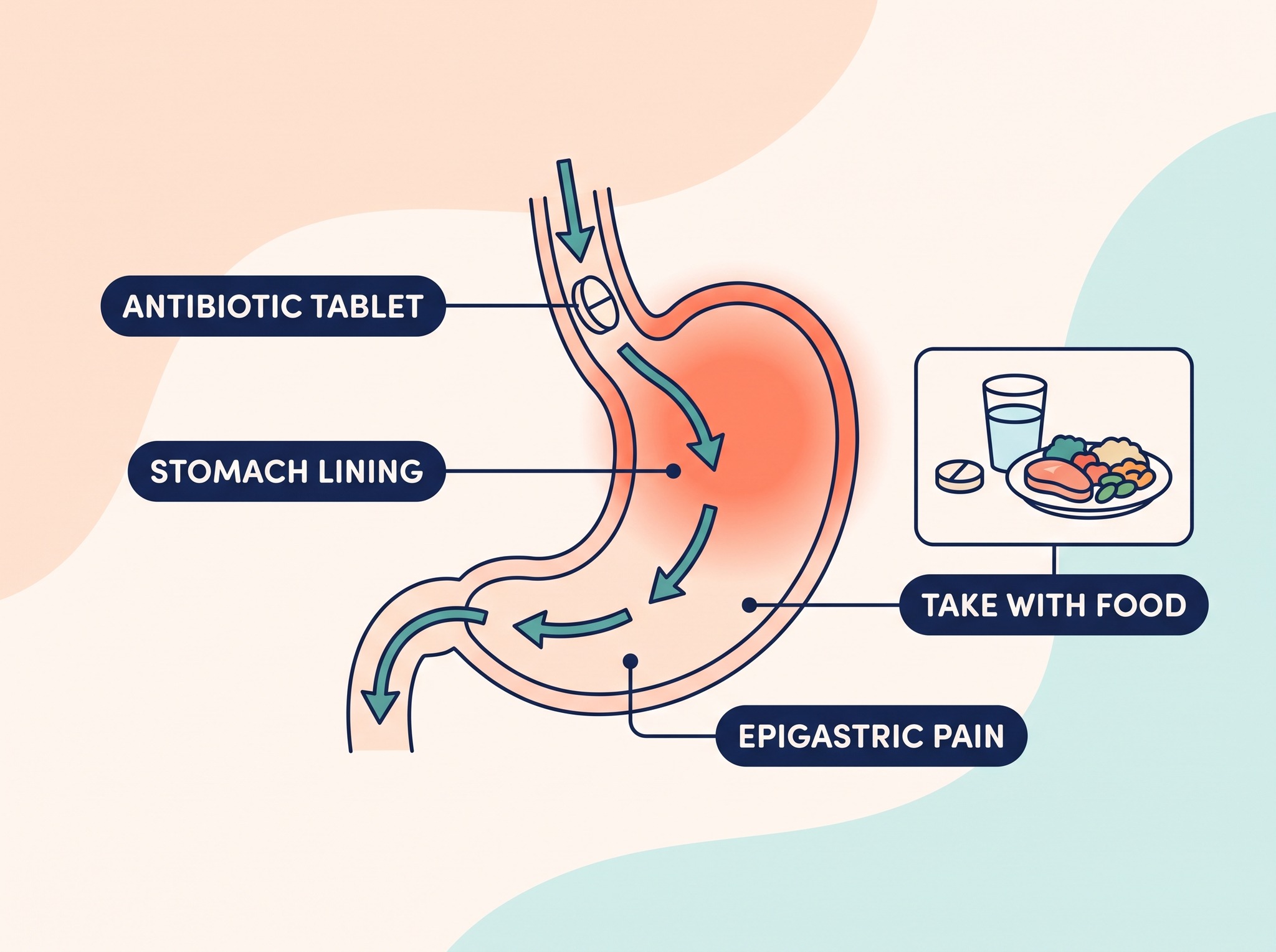 Antibiotics and stomach pain shown as nitrofurantoin exposure alongside the stomach lining and epigastric discomfort.