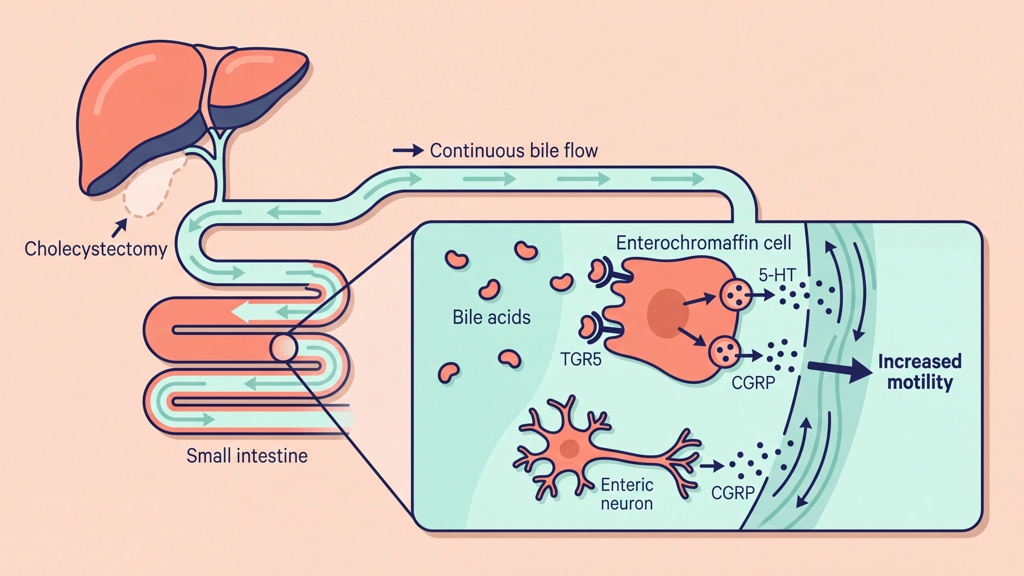 Scientific illustration of bile acid TGR5 signalling after cholecystectomy