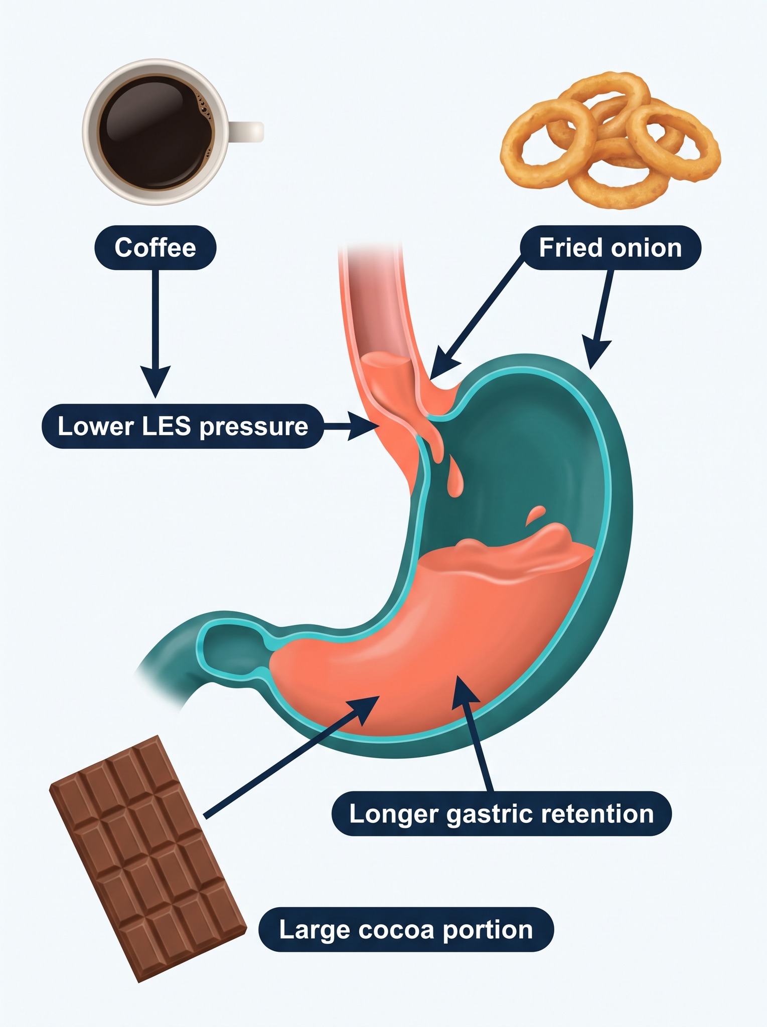 Coffee, fried onion and cocoa worsening acid reflux and gastric retention through different mechanisms