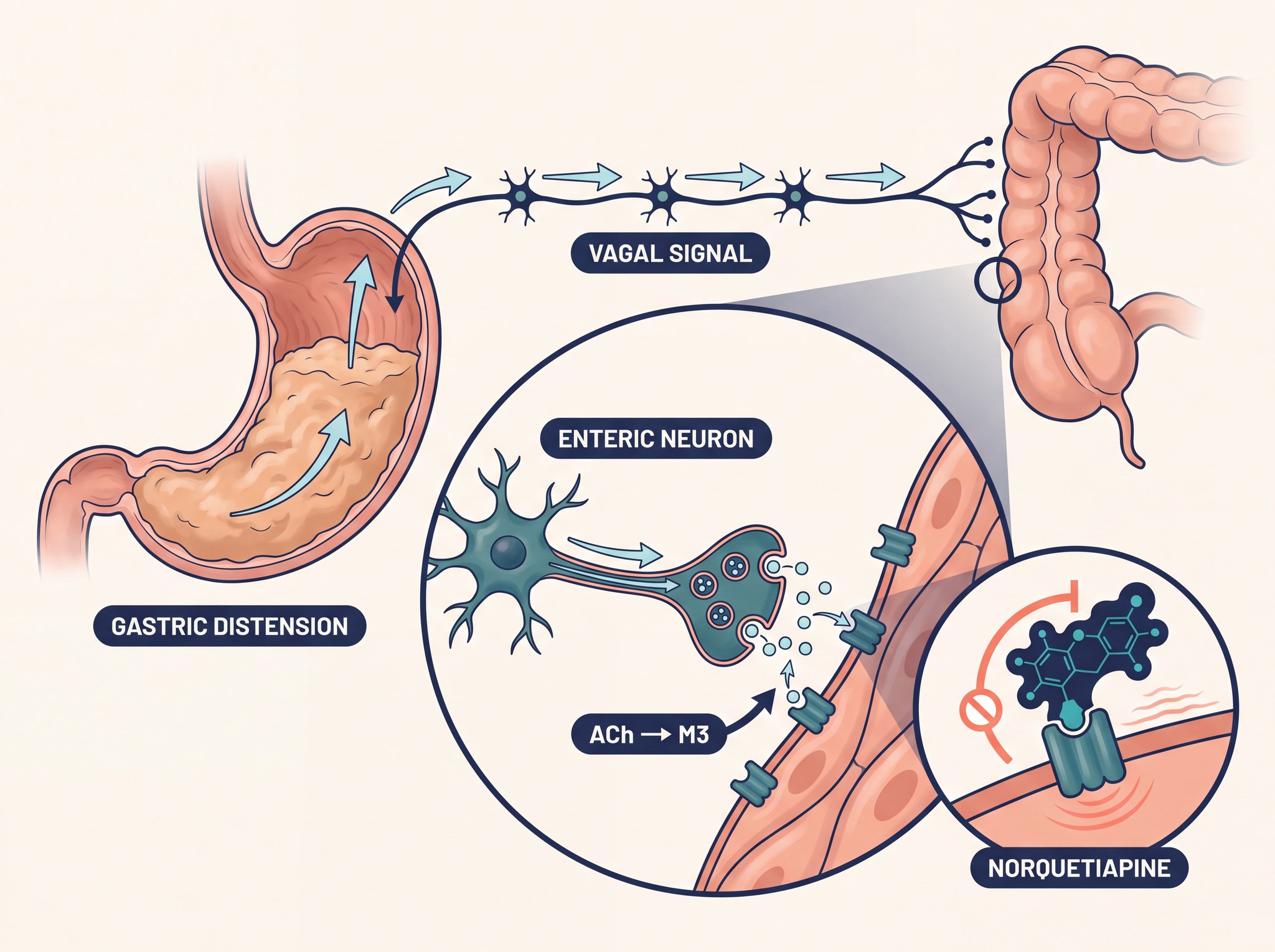 Diagram of the gastrocolic reflex and antagonism of the M3 receptor by norquetiapine