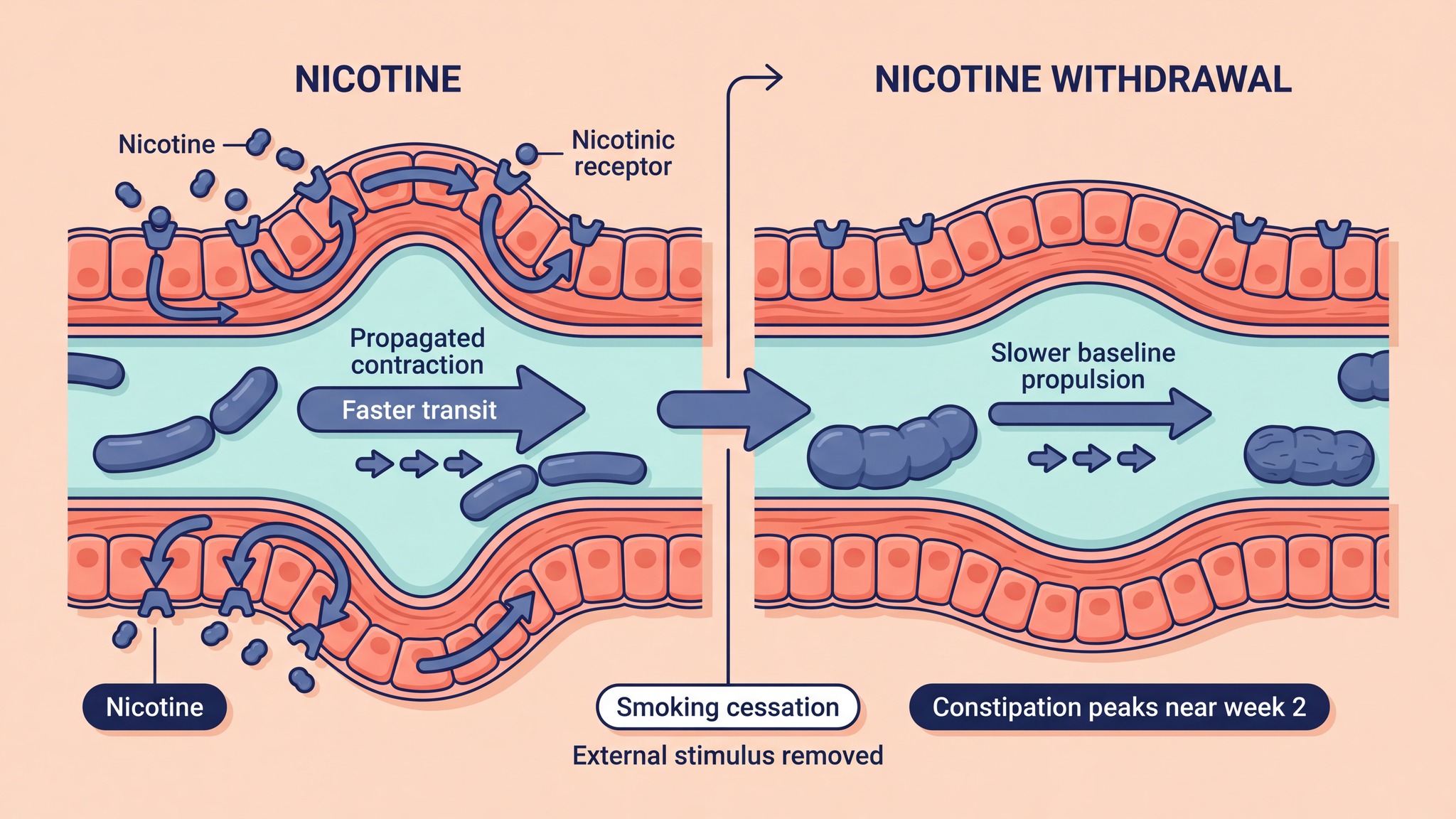Scientific illustration of nicotine stimulation and constipation after smoking cessation