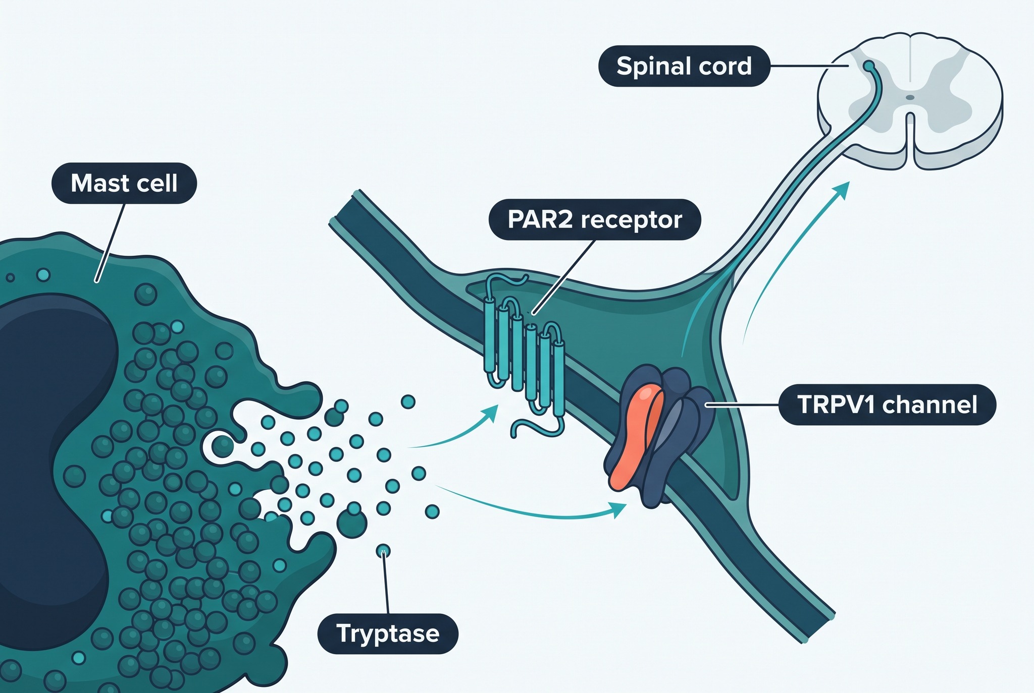 Mast cell releasing tryptase onto PAR2 and TRPV1 on a sensory nerve ending, the mechanism of visceral hypersensitivity in the gut